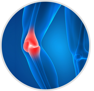 Joint Replacement