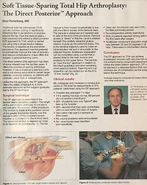 Soft tissue-Sparing Total Hip Arthroplasty